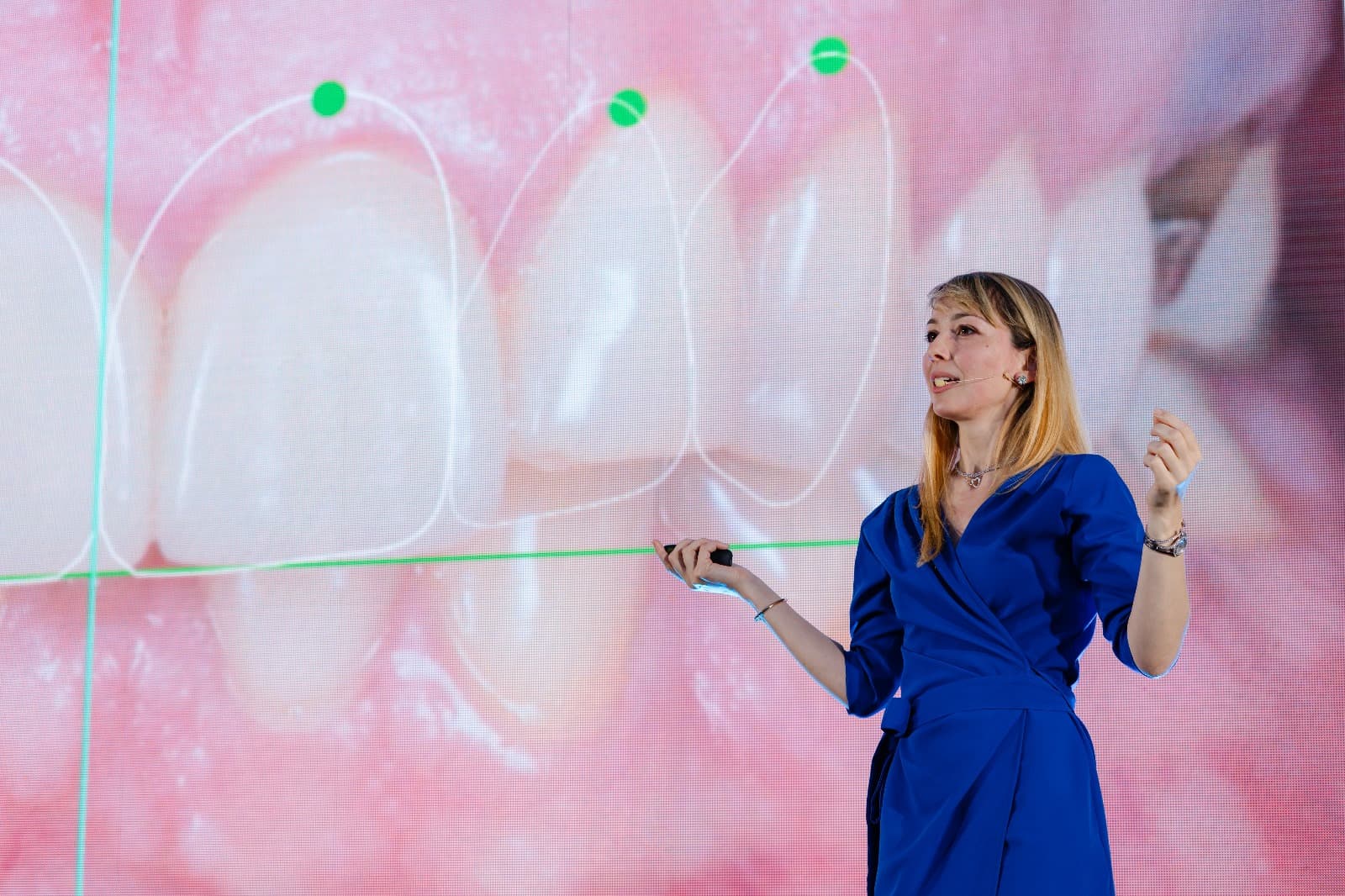 Galerie evenimente AREO